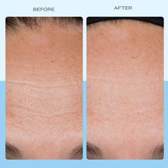 Smoothing cream spread on the face for a plump appearance with First Aid Beauty