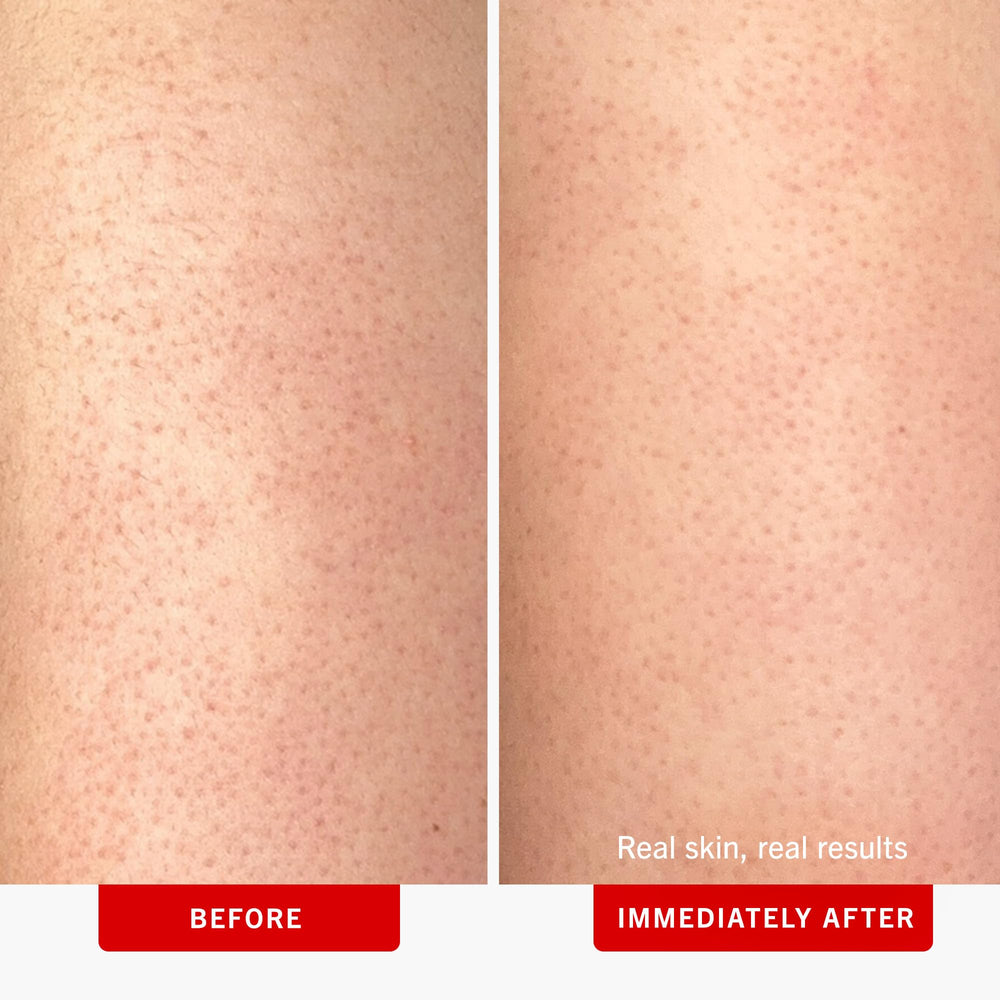 Exfoliating beads close-up from First Aid Beauty KP Bump Eraser