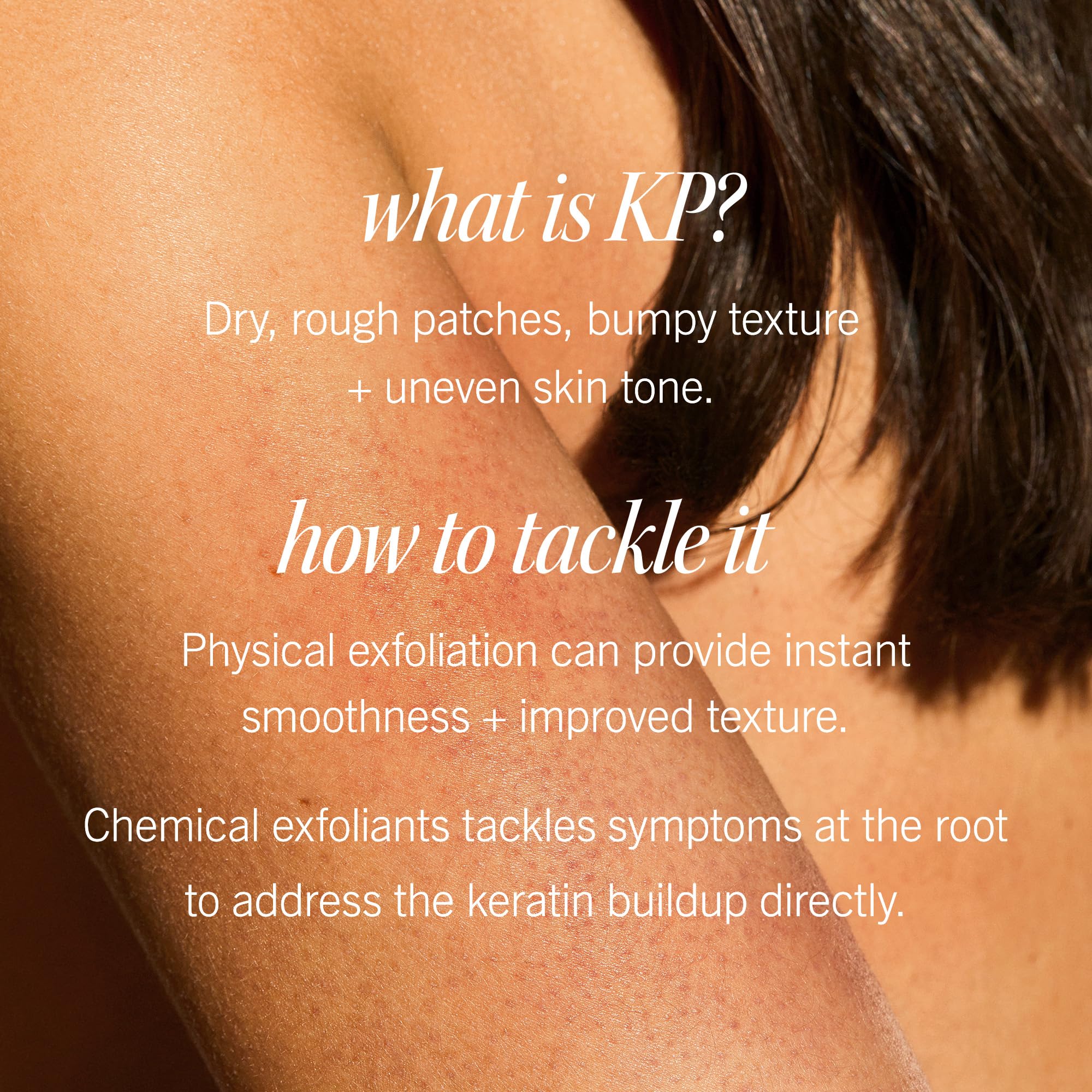 First Aid Beauty KP Bump Eraser pumice beads close-up showing non-plastic exfoliation.