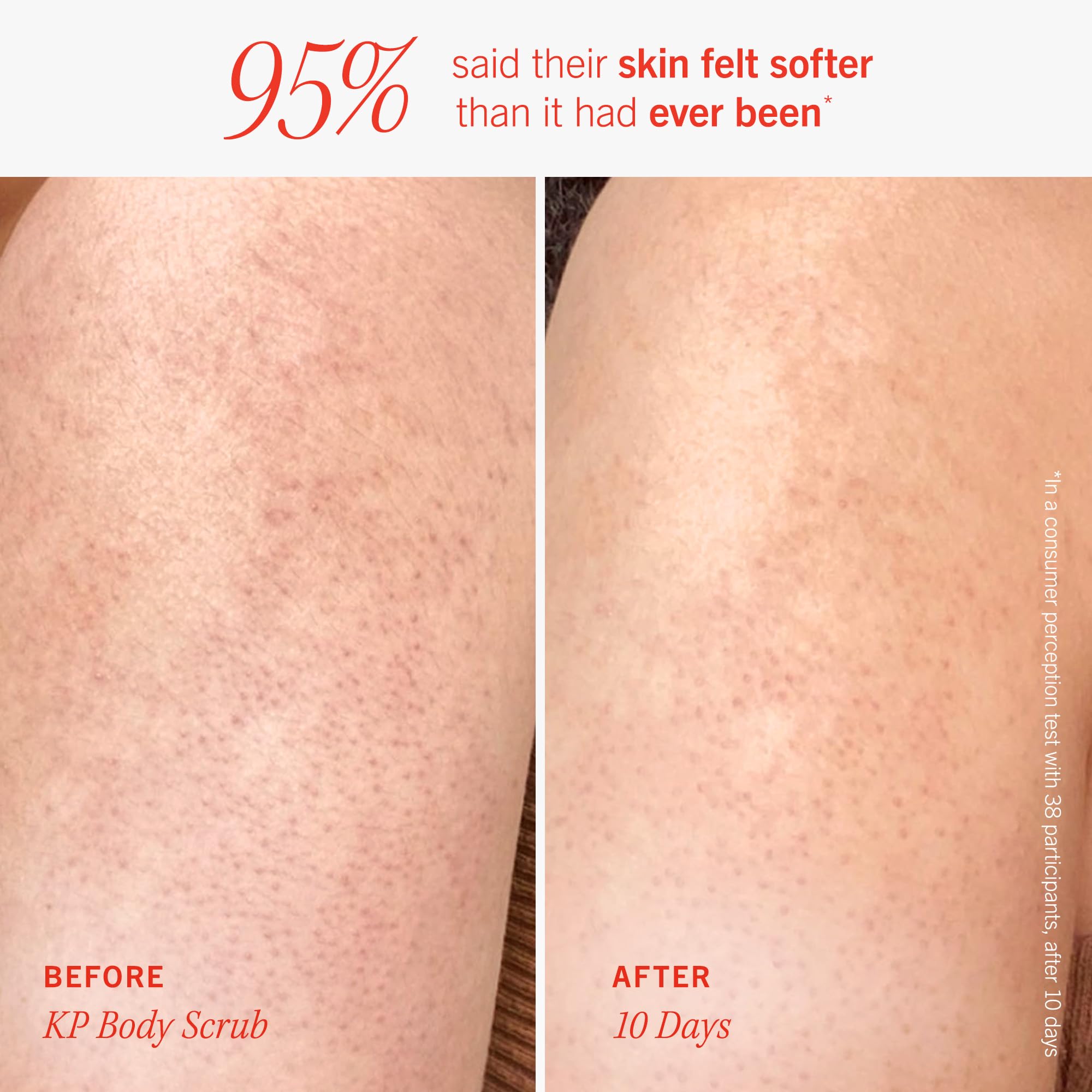 First Aid Beauty KP Bump Eraser scrub texture close-up with exfoliating particles