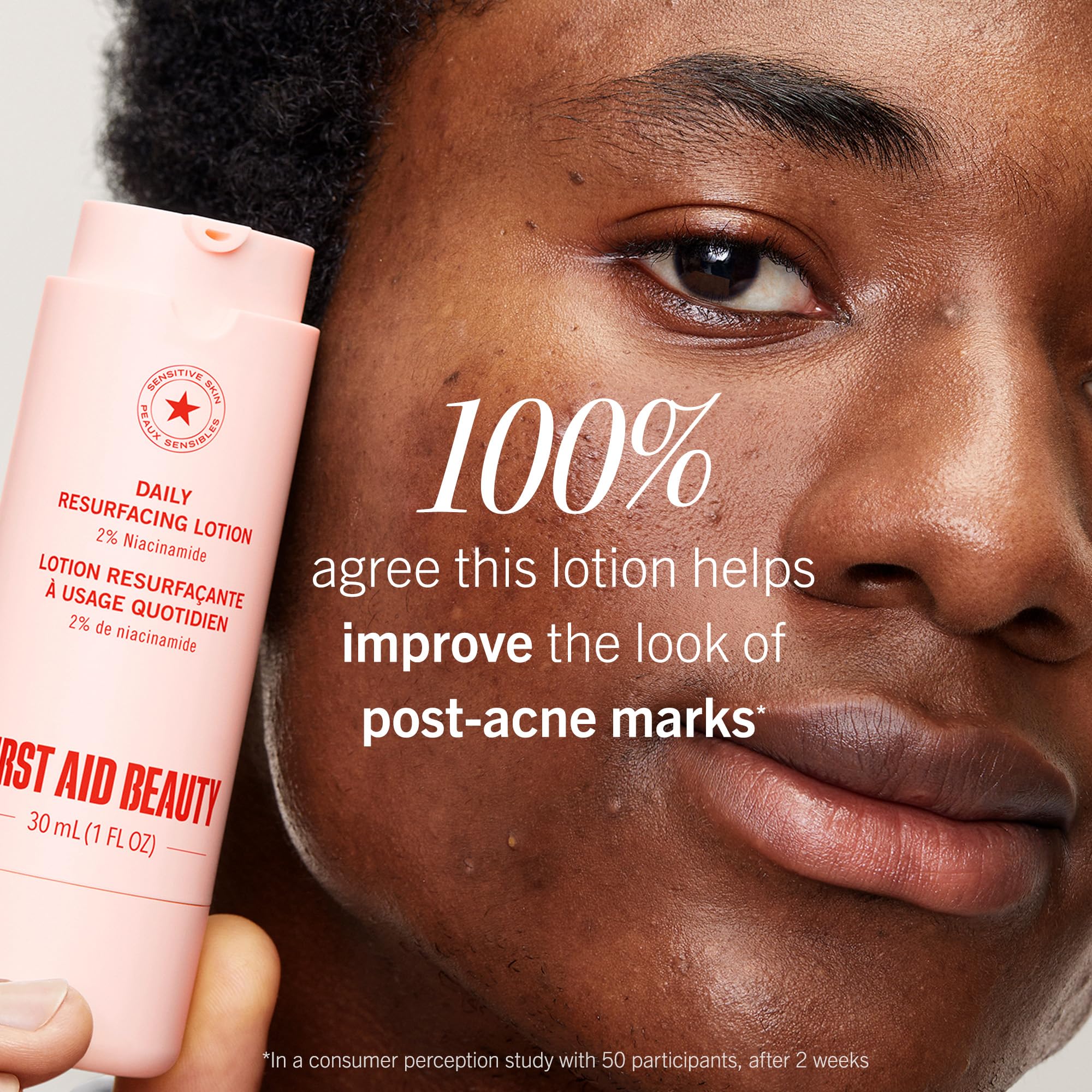 First Aid Beauty niacinamide 2pct lotion bottle, targets post-acne tone