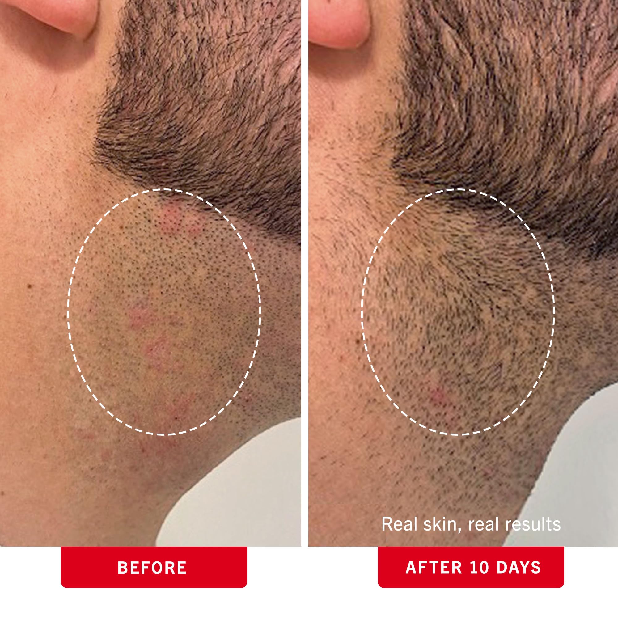 First Aid Beauty close-up showing glycolic and salicylic acids for gentle exfoliation.