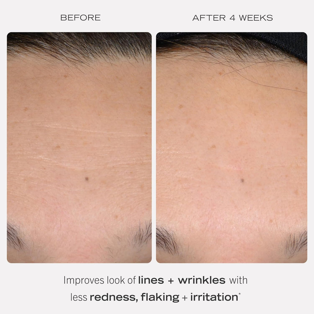 First Aid Beauty retinol complex serum pump demonstrates easy, controlled application for sensitive skin