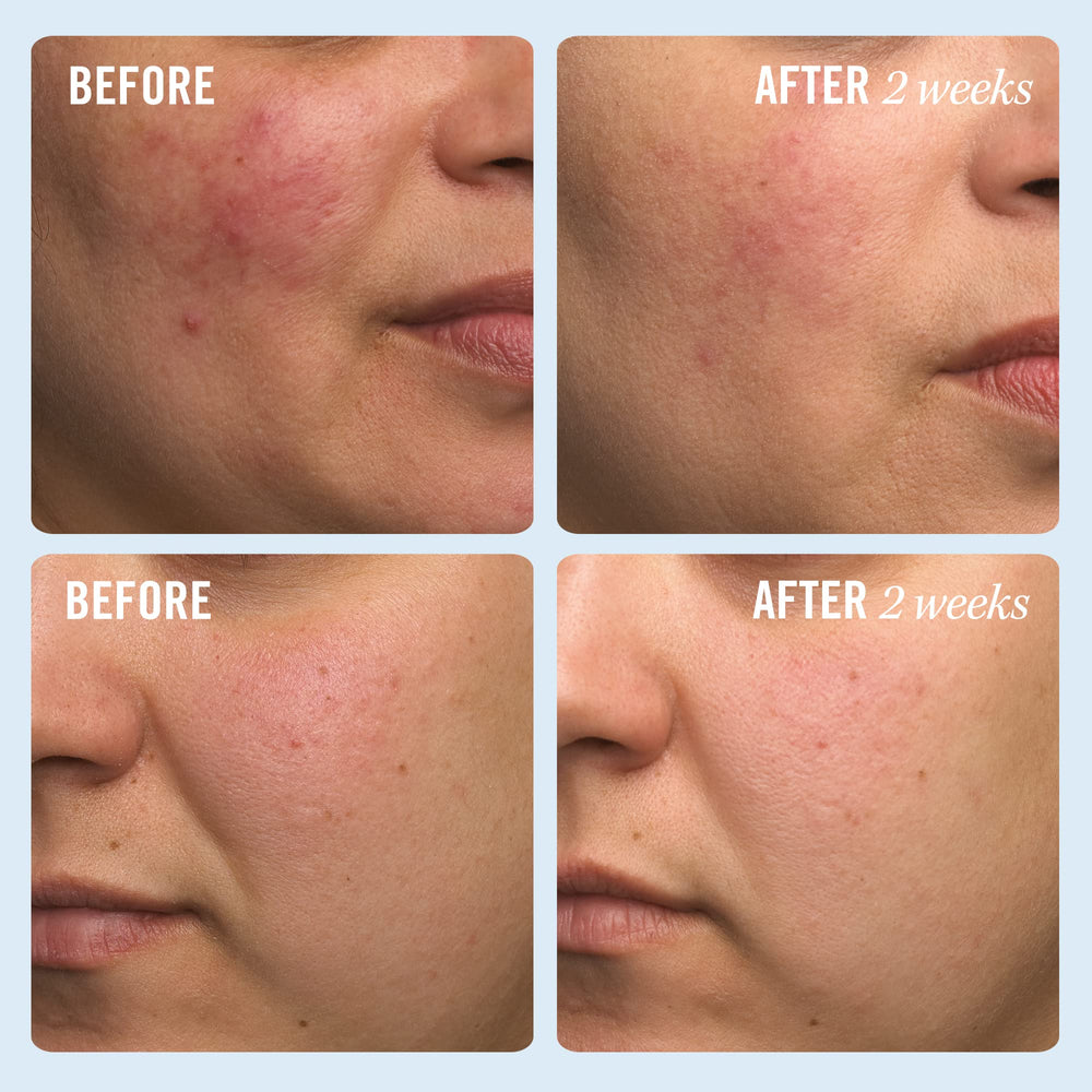 First Aid Beauty Ultra Repair Cream aplicación manual para rostro y cuerpo.