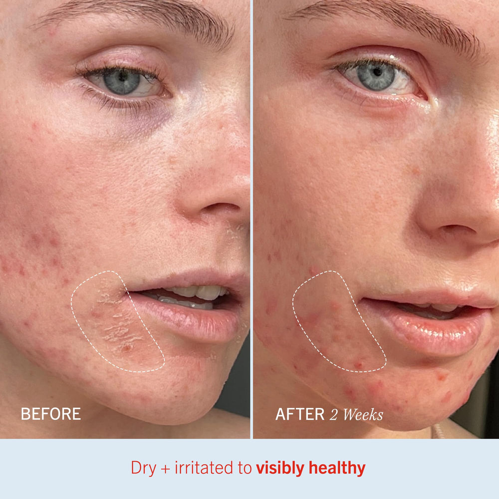 Label highlight showing colloidal oatmeal in Ultra Repair Cream