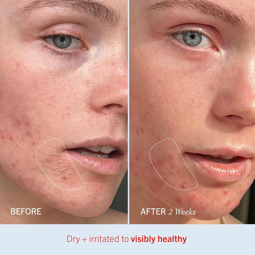 First Aid Beauty Ultra Repair Cream vanilla cinnamon scent adds comforting routine notes.