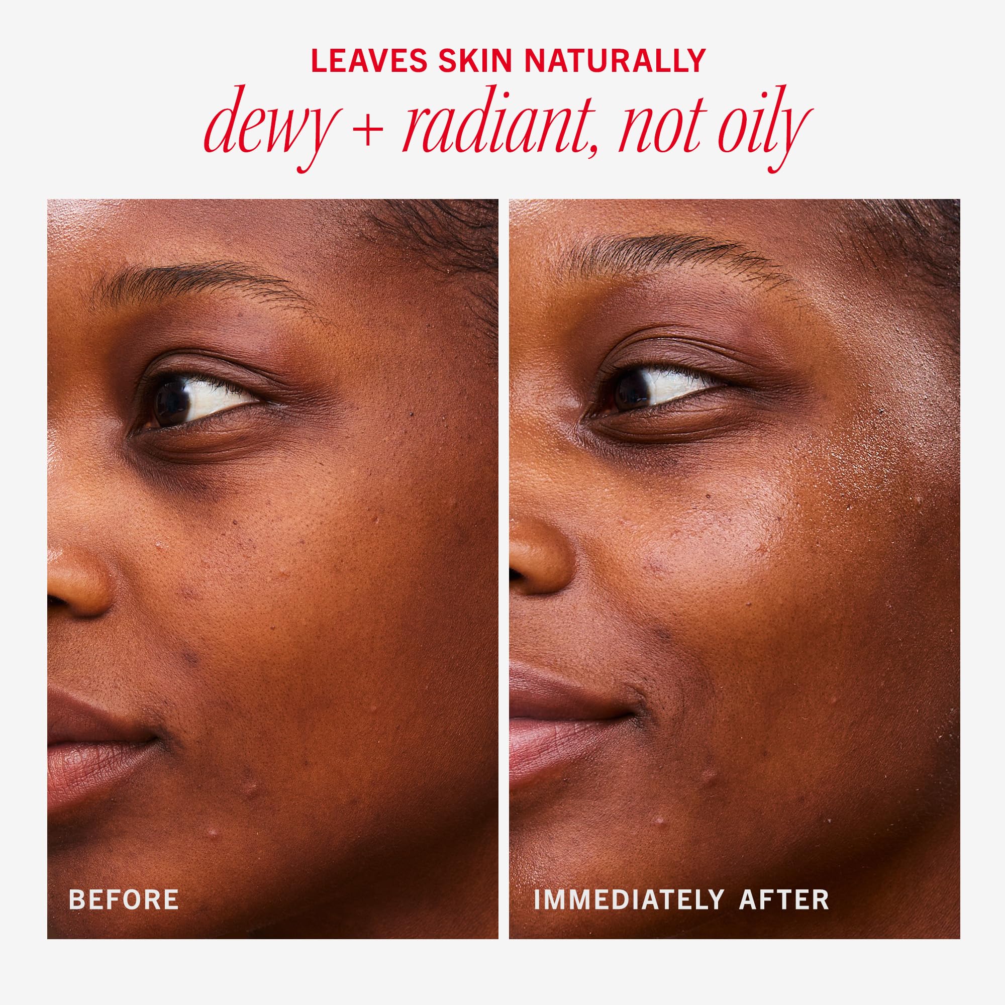 First Aid Beauty Hydrating Dewy Gel Cream oil-free formula balancing shine on skin.