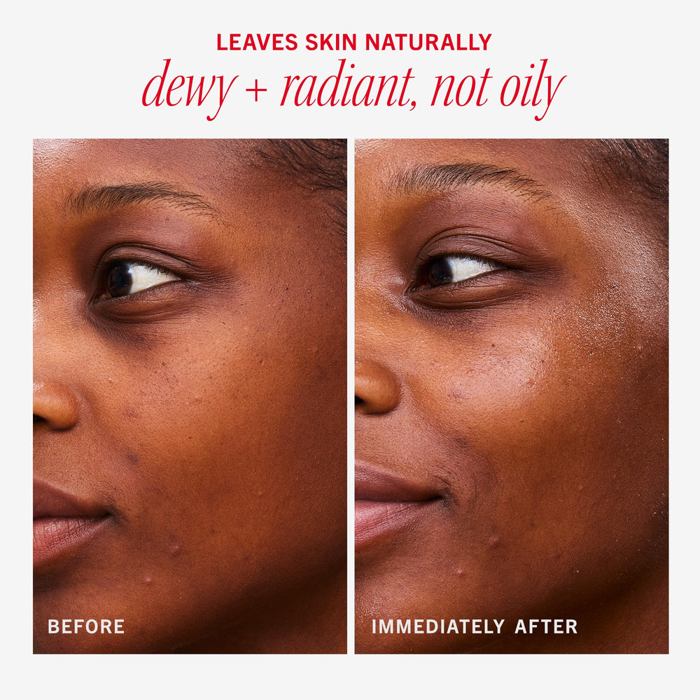 First Aid Beauty Hydrating Dewy Gel Cream oil-free formula balancing shine on skin.