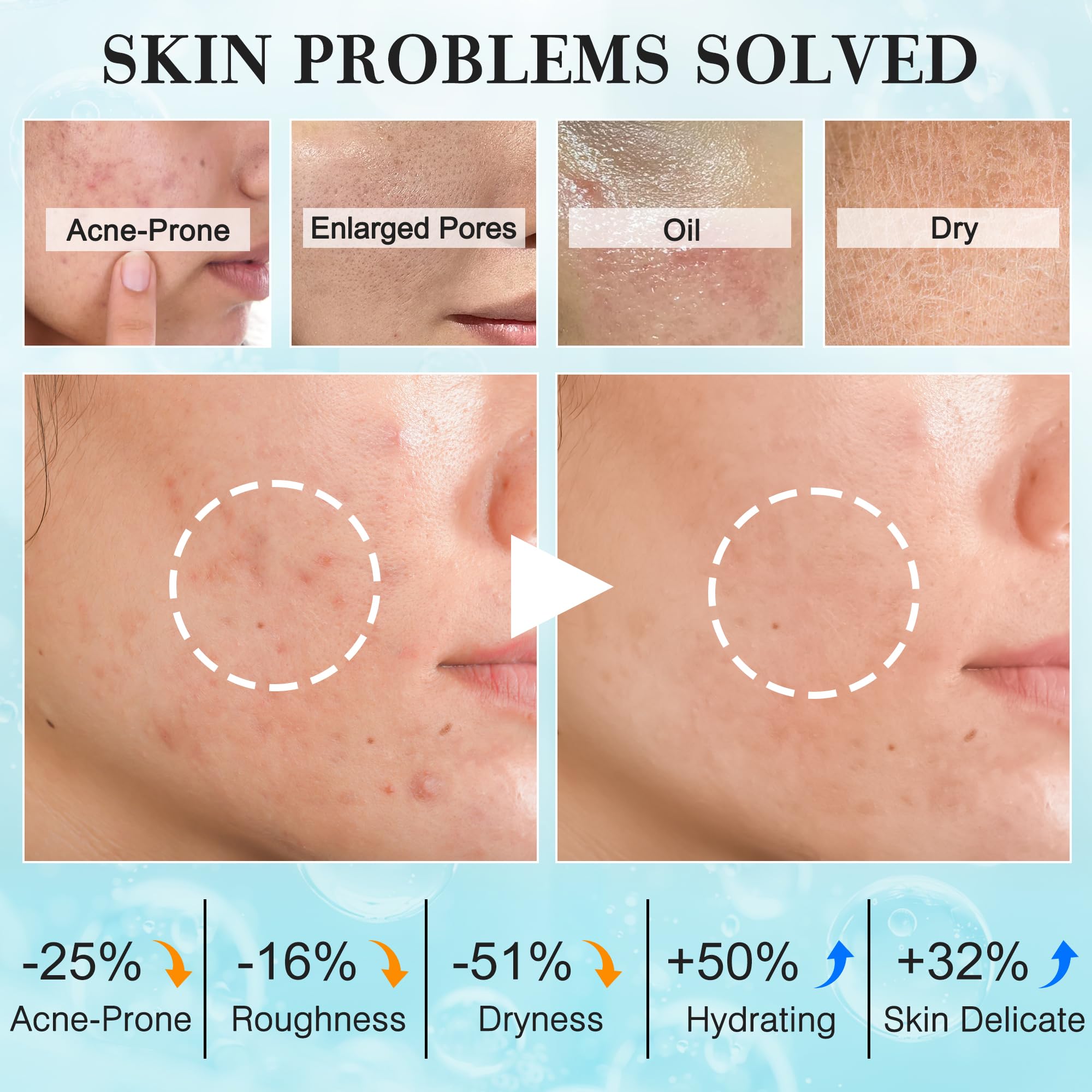 FITOEG teen-skin-care-kit-serum: lightweight hydration to smooth texture and even tone