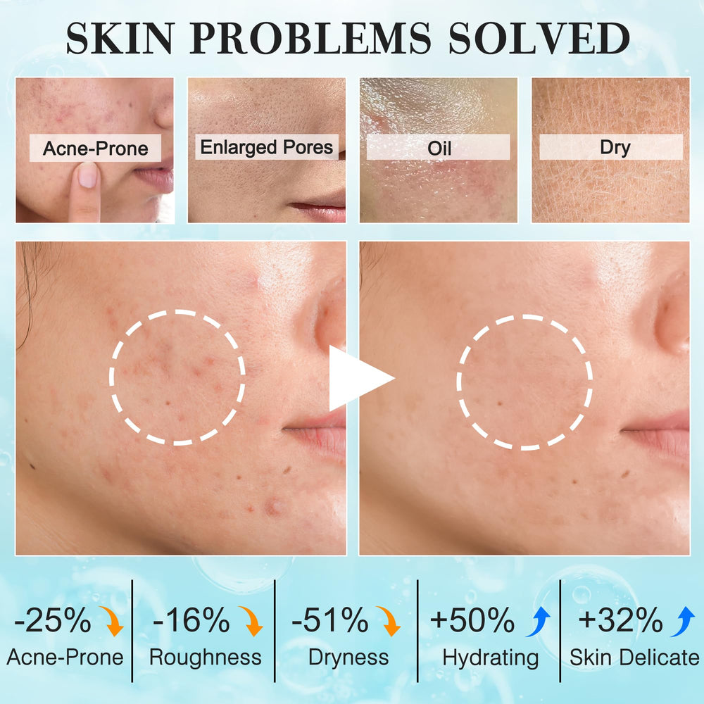 FITOEG teen-skin-care-kit-serum: lightweight hydration to smooth texture and even tone