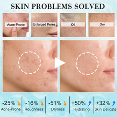 FITOEG teen-skin-care-kit-serum: lightweight hydration to smooth texture and even tone