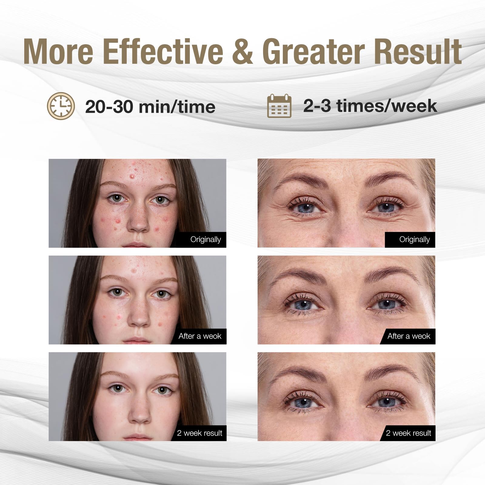 F FIWENE blue-light session image emphasizes acne inflammation control potential.