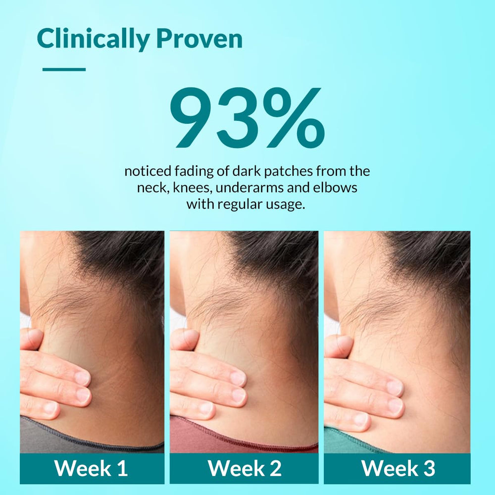 Armpit usage with Fixderma Nigrifix delivers refreshing, non-greasy feel
