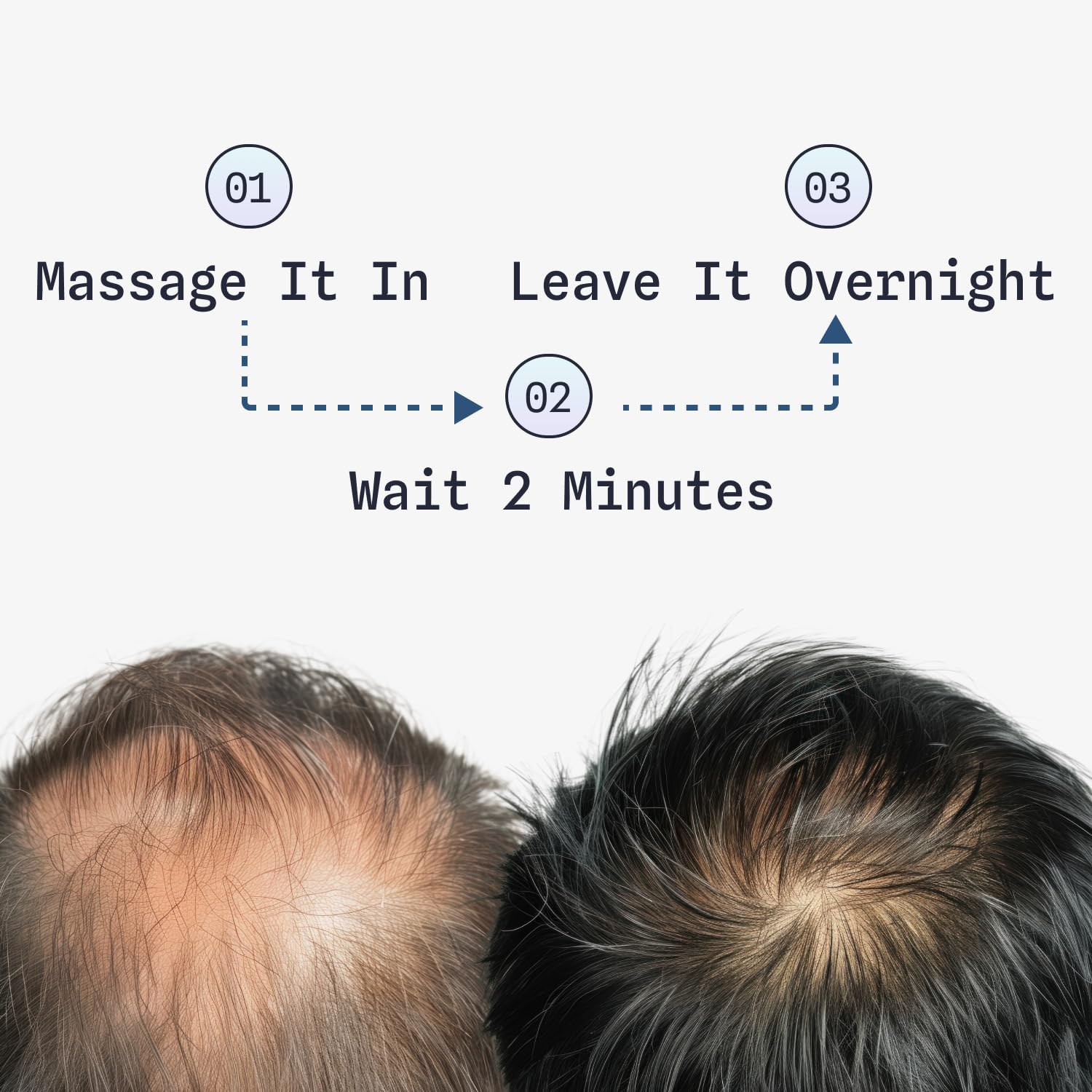 Fleava ingredients like peptides and biotin illustrated for scalp health.