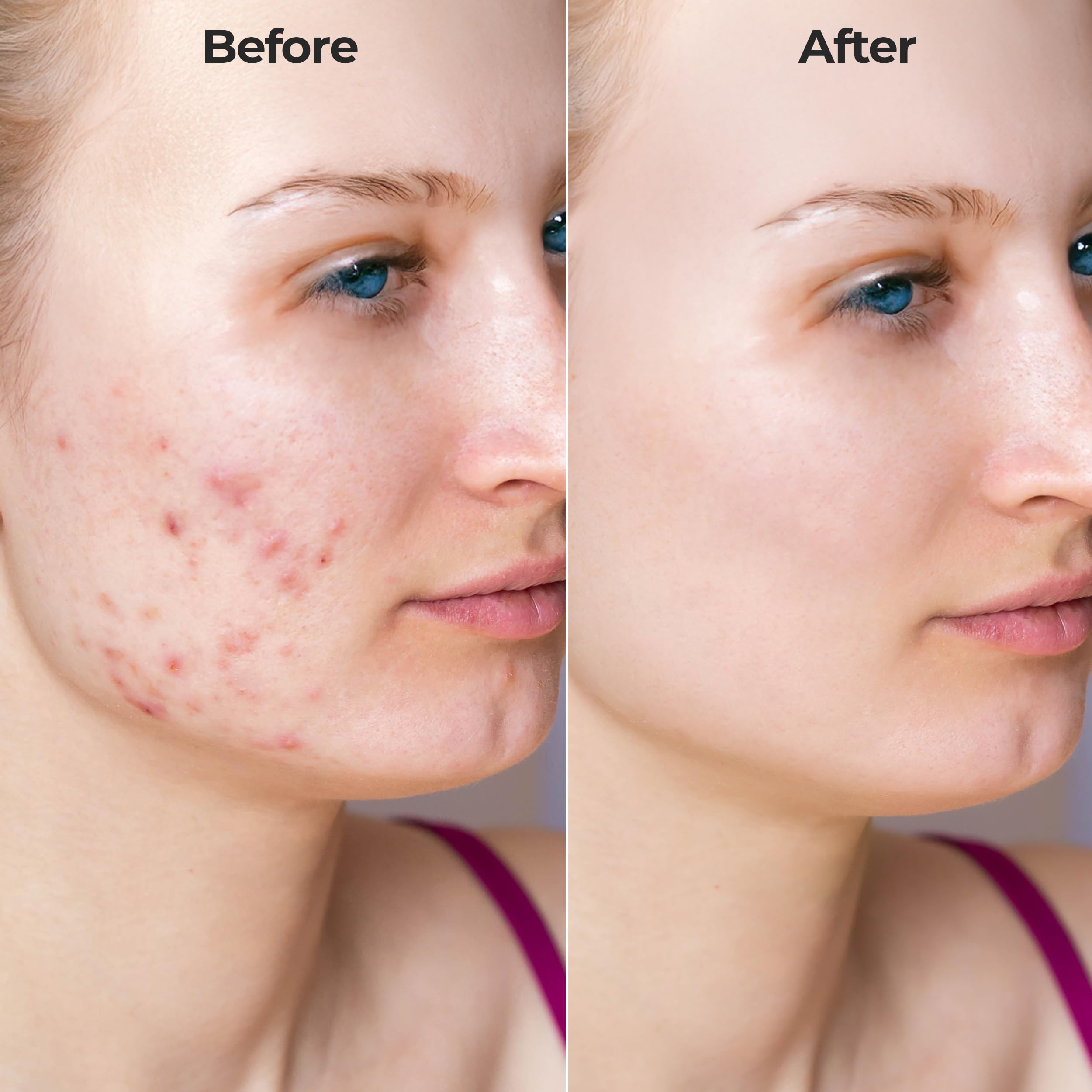 FLexiknee Microrevive serum bottle highlighting hyaluronic acid and hydration