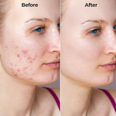 FLexiknee Microrevive serum bottle highlighting hyaluronic acid and hydration