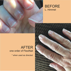 FlexiNail daily-25sec-application offers a quick regimen for nail care.
