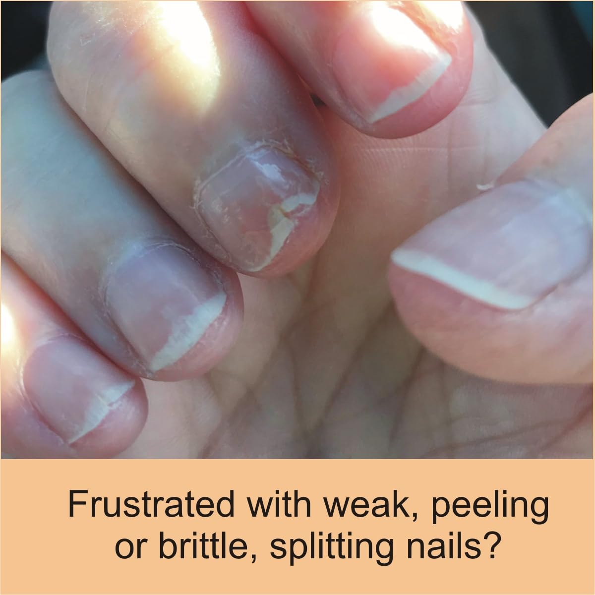 FlexiNail nails-closeup-weak-nails demonstrates visible support for fragile nails.