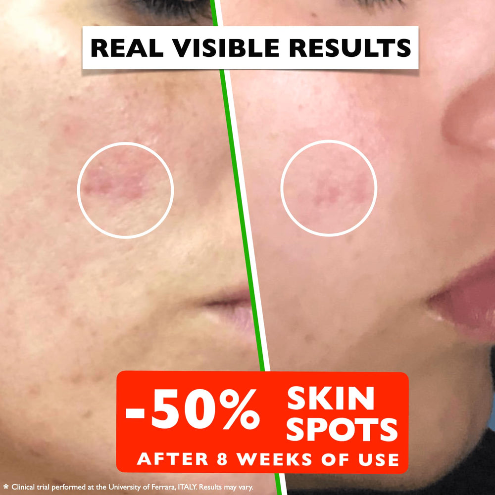 Florence vitamin c serum ingredients-closeup highlights natural actives