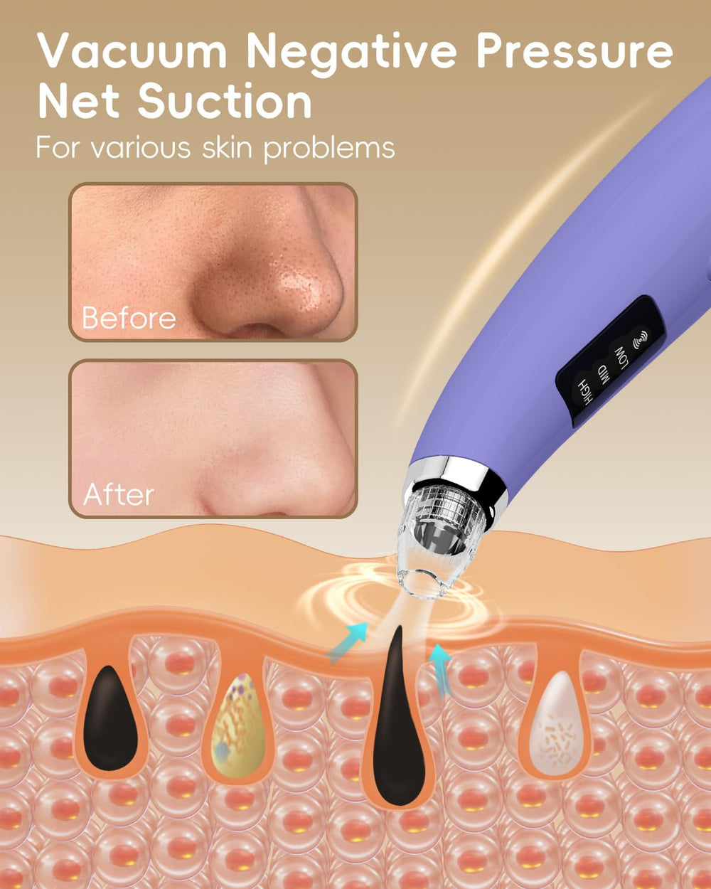 FLYMOOO fore cleaner suction levels for customizable facial care