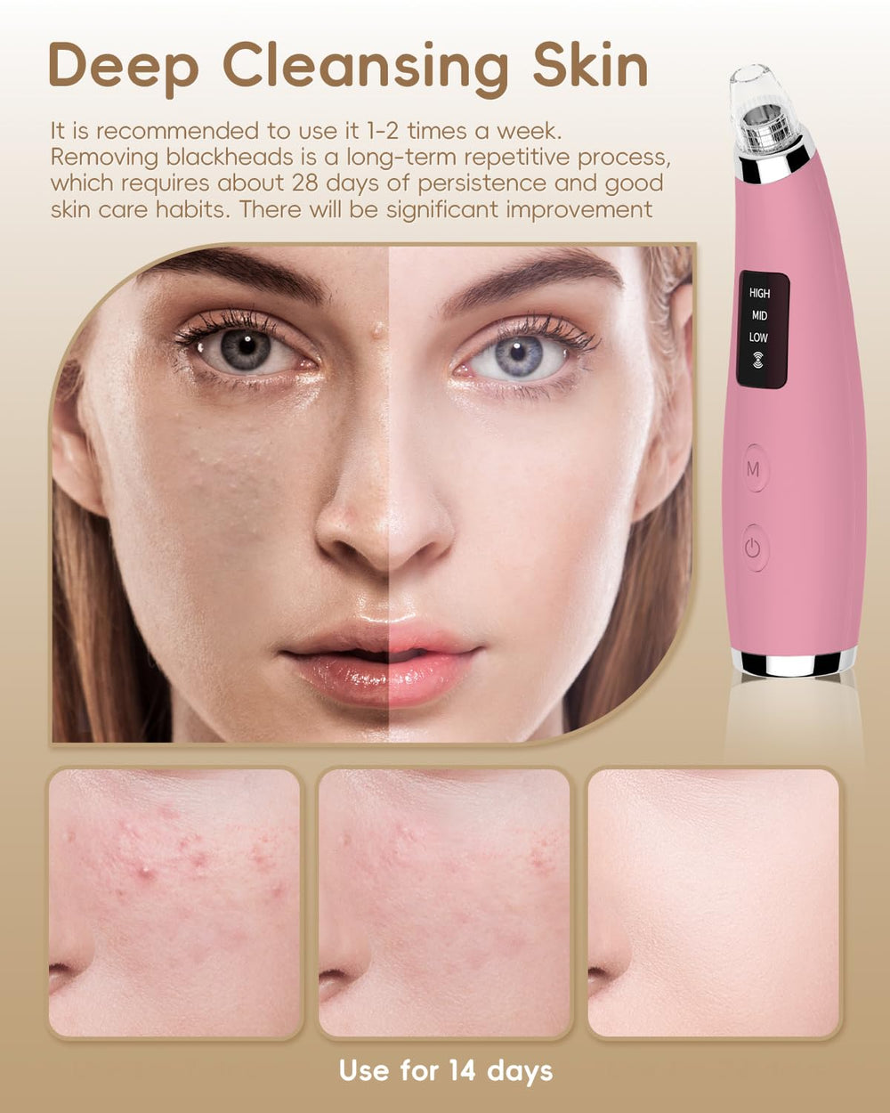 FLYMOO pore vacuum LED display demonstrates easy power level selection for precise skincare.