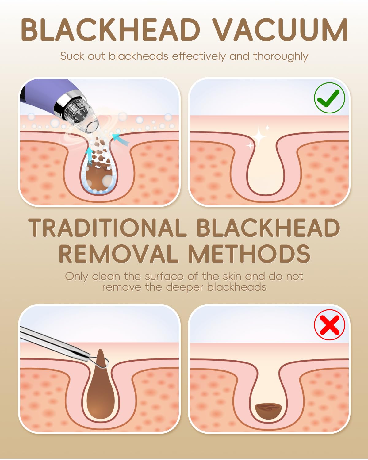 FLYMOOO pore vacuum mid-level use on oily zones for balanced skin