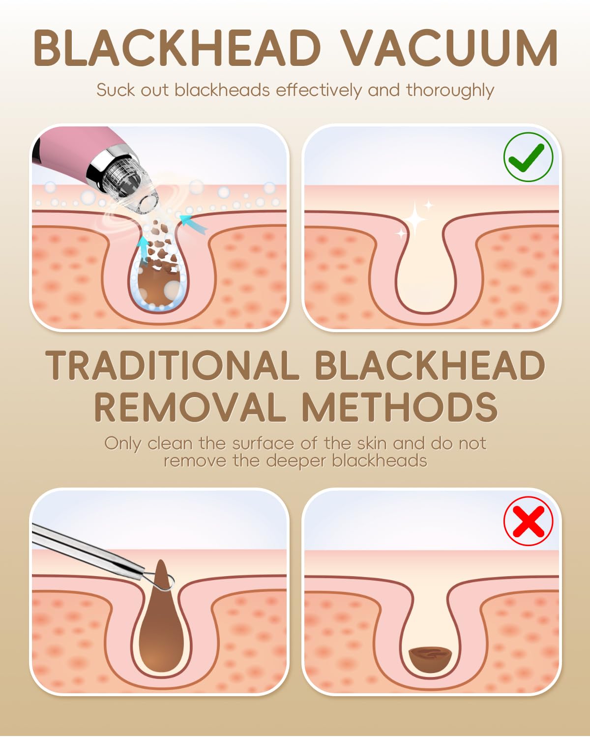 FLYMOO suction levels image highlights High, Mid, and Low options for customizable pore care.