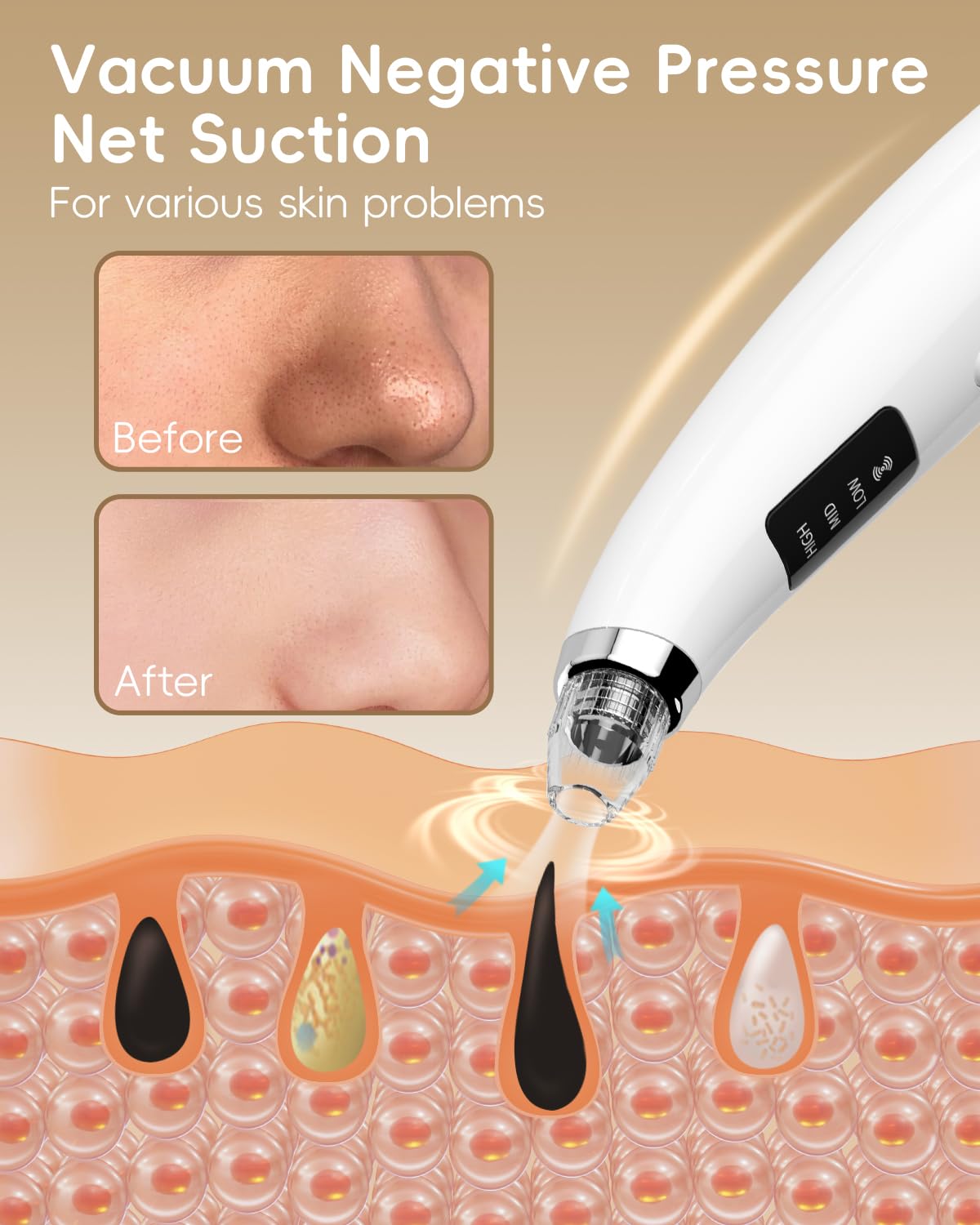 Flymooo LCD display on the blackhead vacuum shows suction and battery status