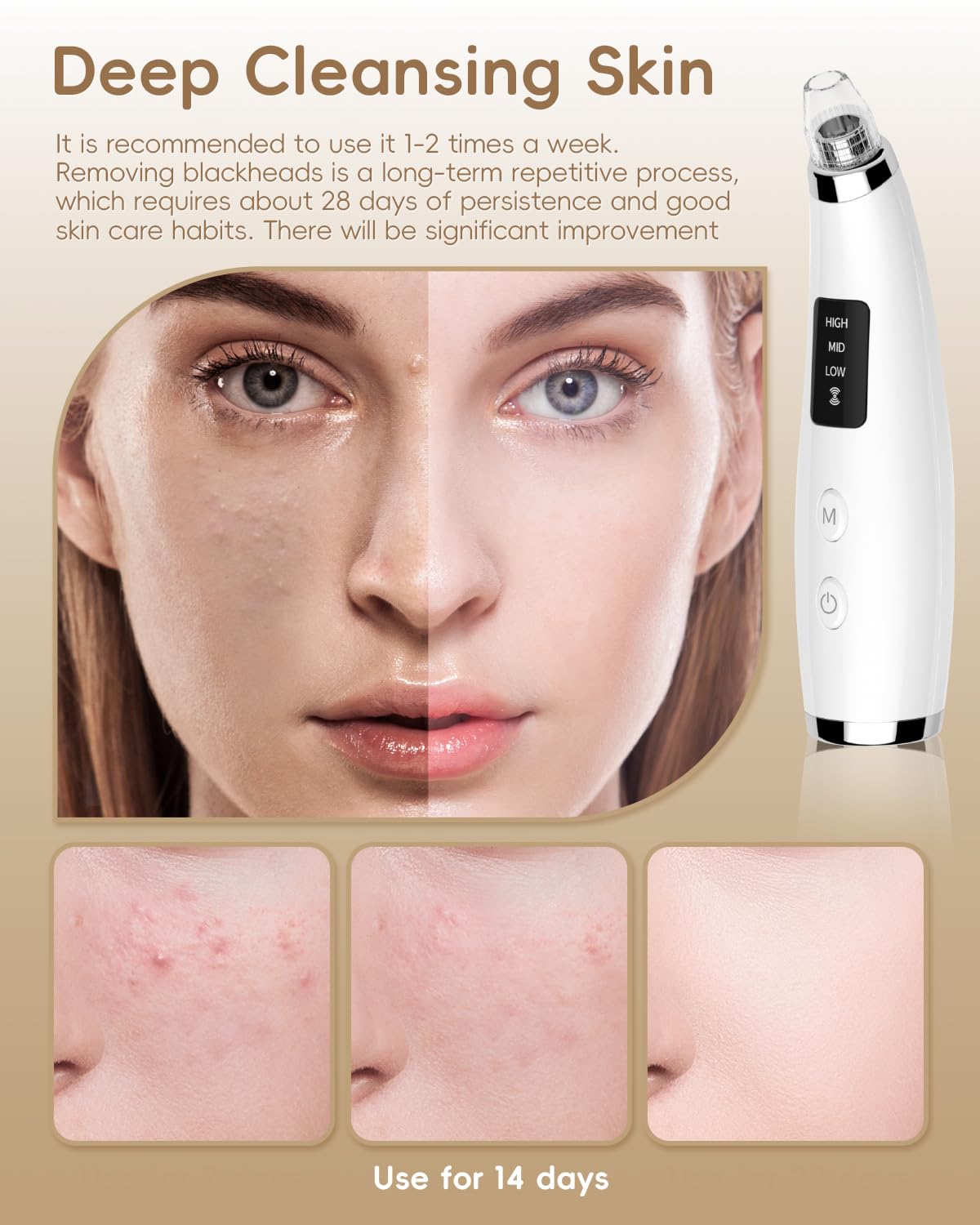 Flymooo suction level options for gentle to powerful skin care