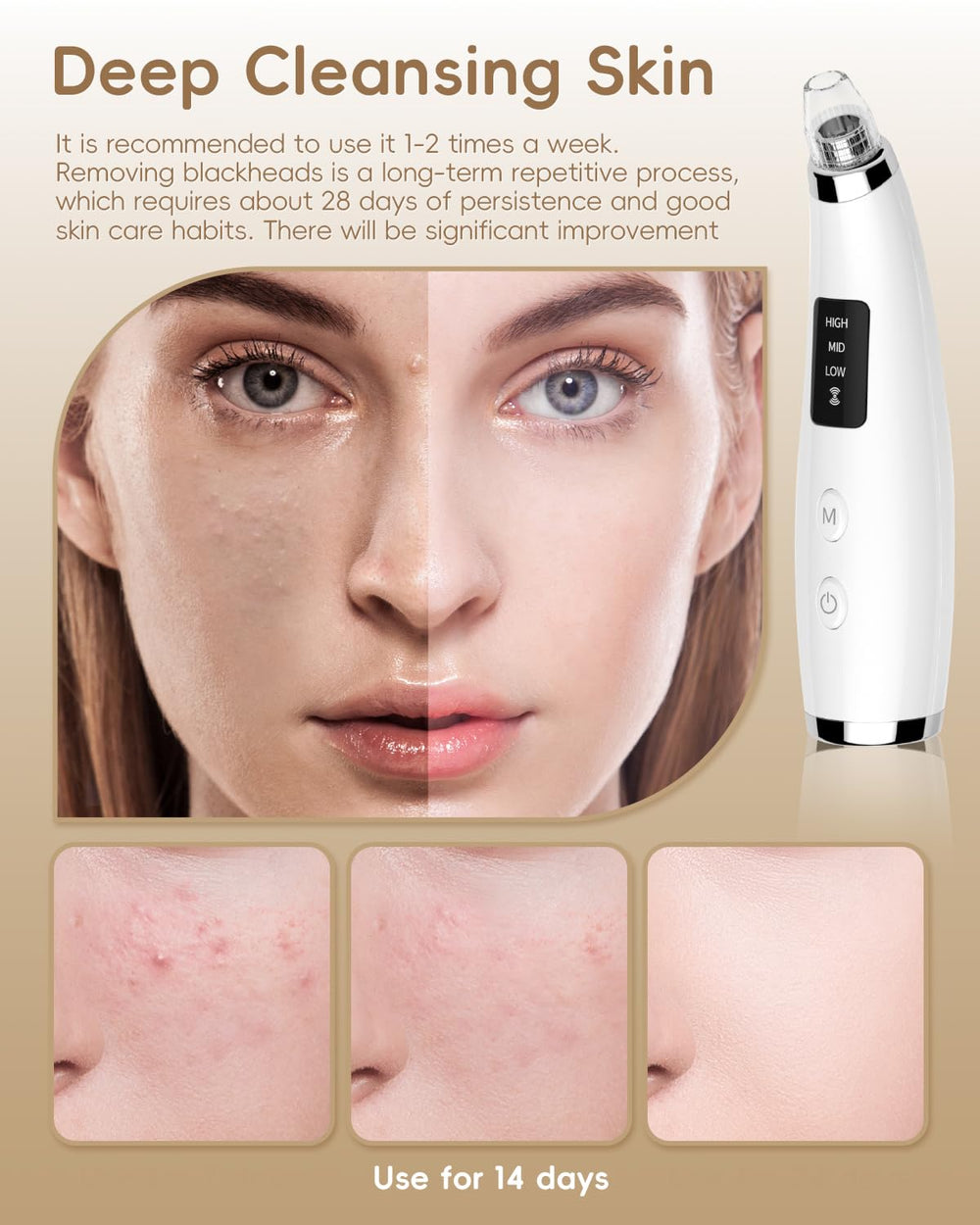 Flymooo suction level options for gentle to powerful skin care