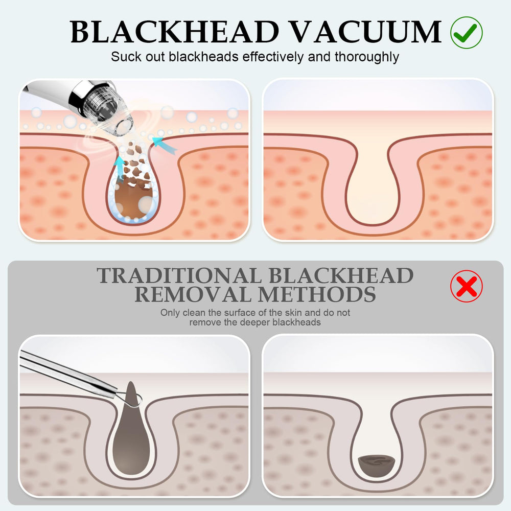 FLYMOOO Facial Pore Vacuum LED display enables easy power level selection