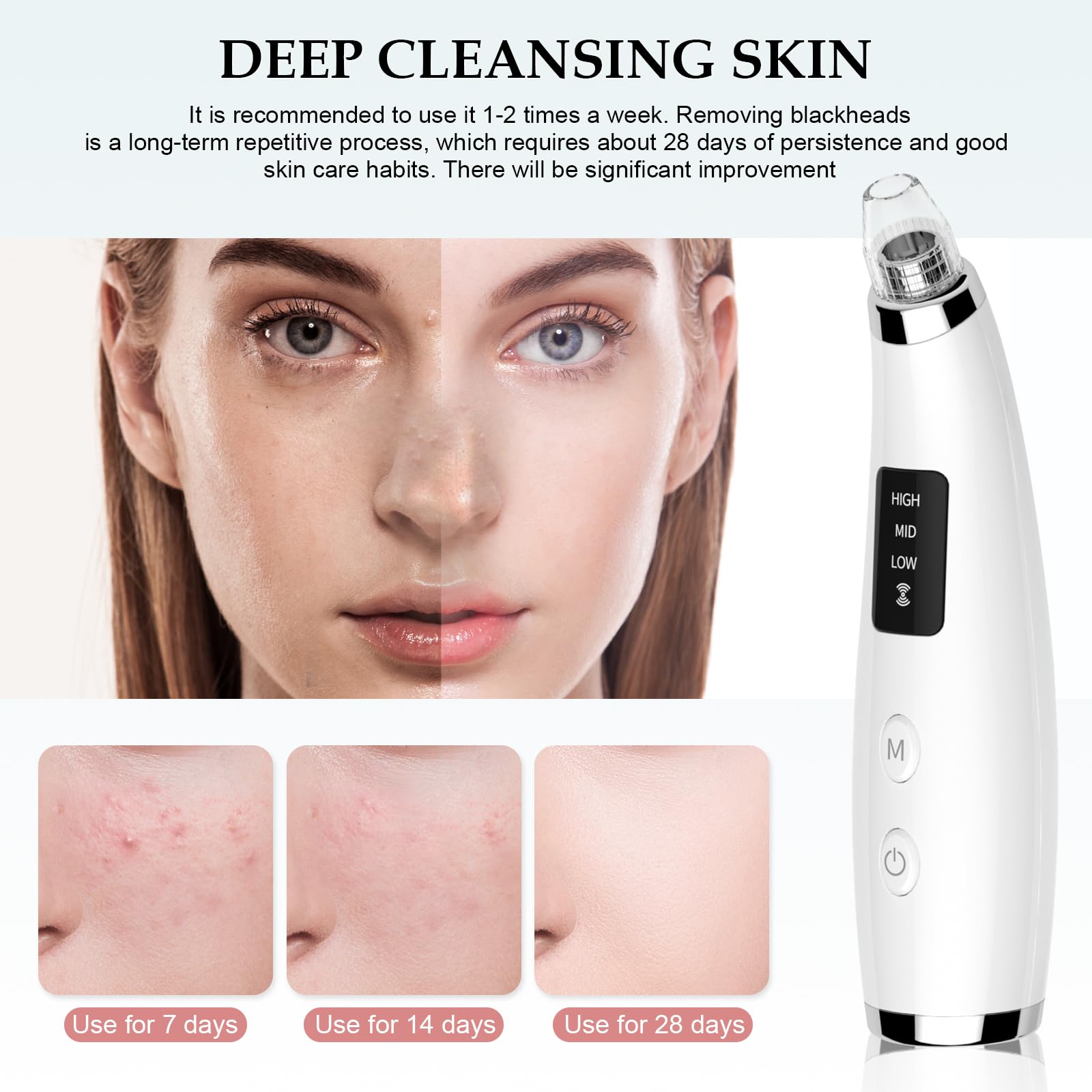 FLYMOOO Facial Pore Vacuum in-use demo demonstrates attachments for facial areas