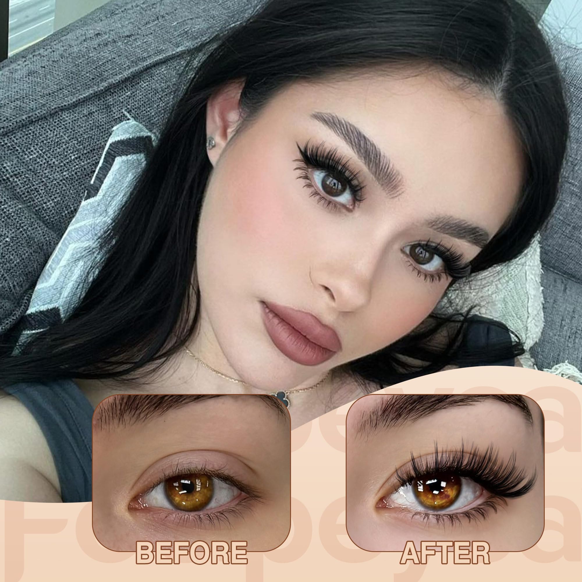 Focipeysa lower cluster kit improves eye balance and depth