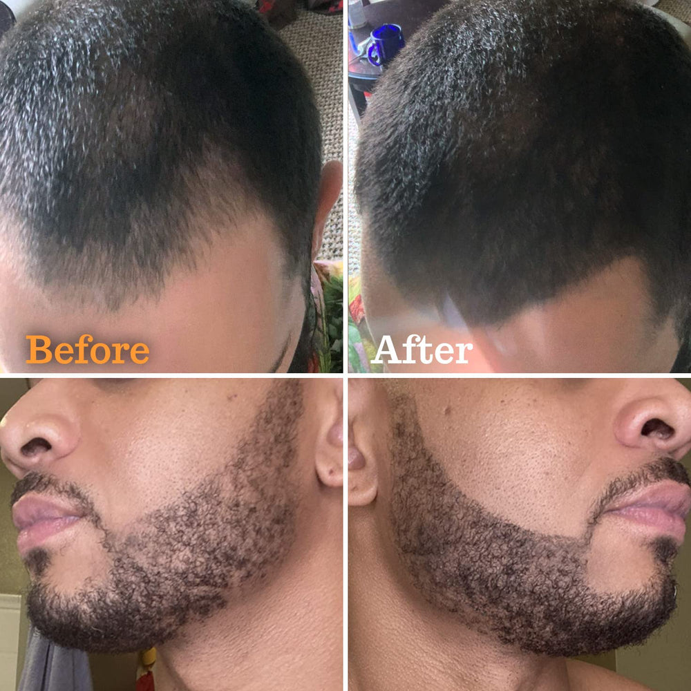 FOLLICLE BOOSTER Beard Pen normal pencil used for precise color touch-ups.