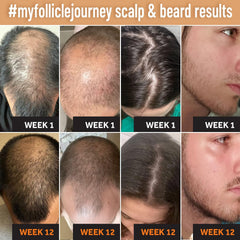 Follicle Booster shampoo on shower shelf for daily cleansing