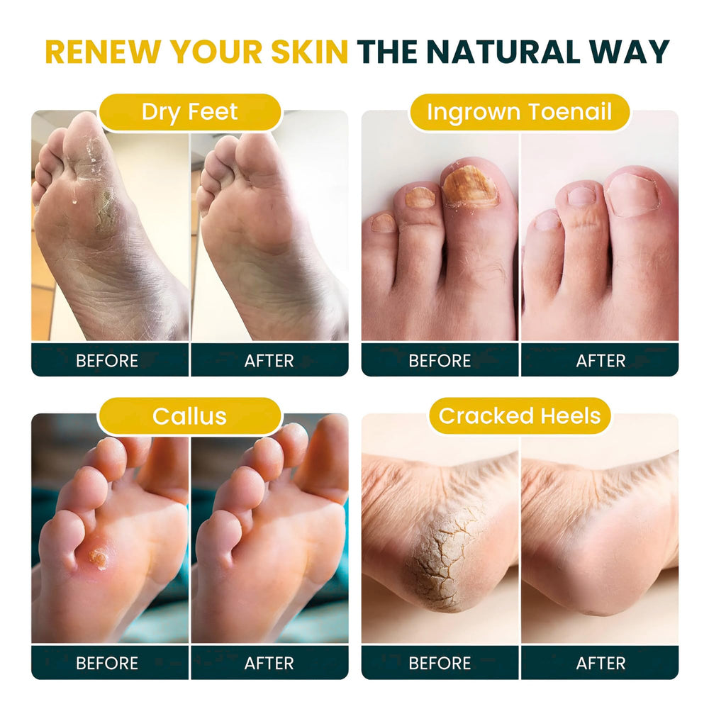 Foot Cure Citrus Detox foot soak package opened with lemon slices for spa-like ritual.