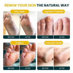 Foot Cure Citrus Detox foot soak package opened with lemon slices for spa-like ritual.