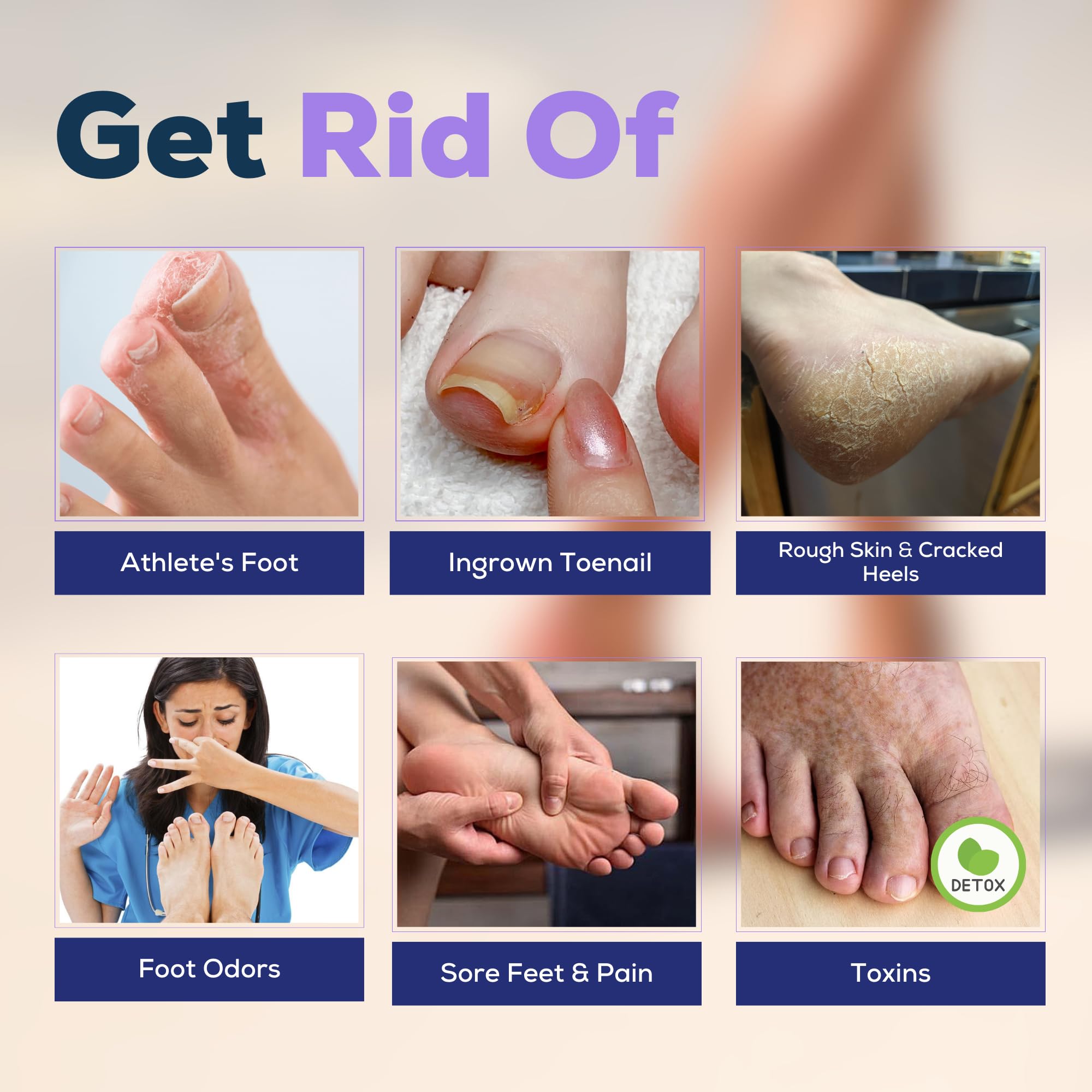 Foot Cure foot scrubber removes dead skin for smoother feet.