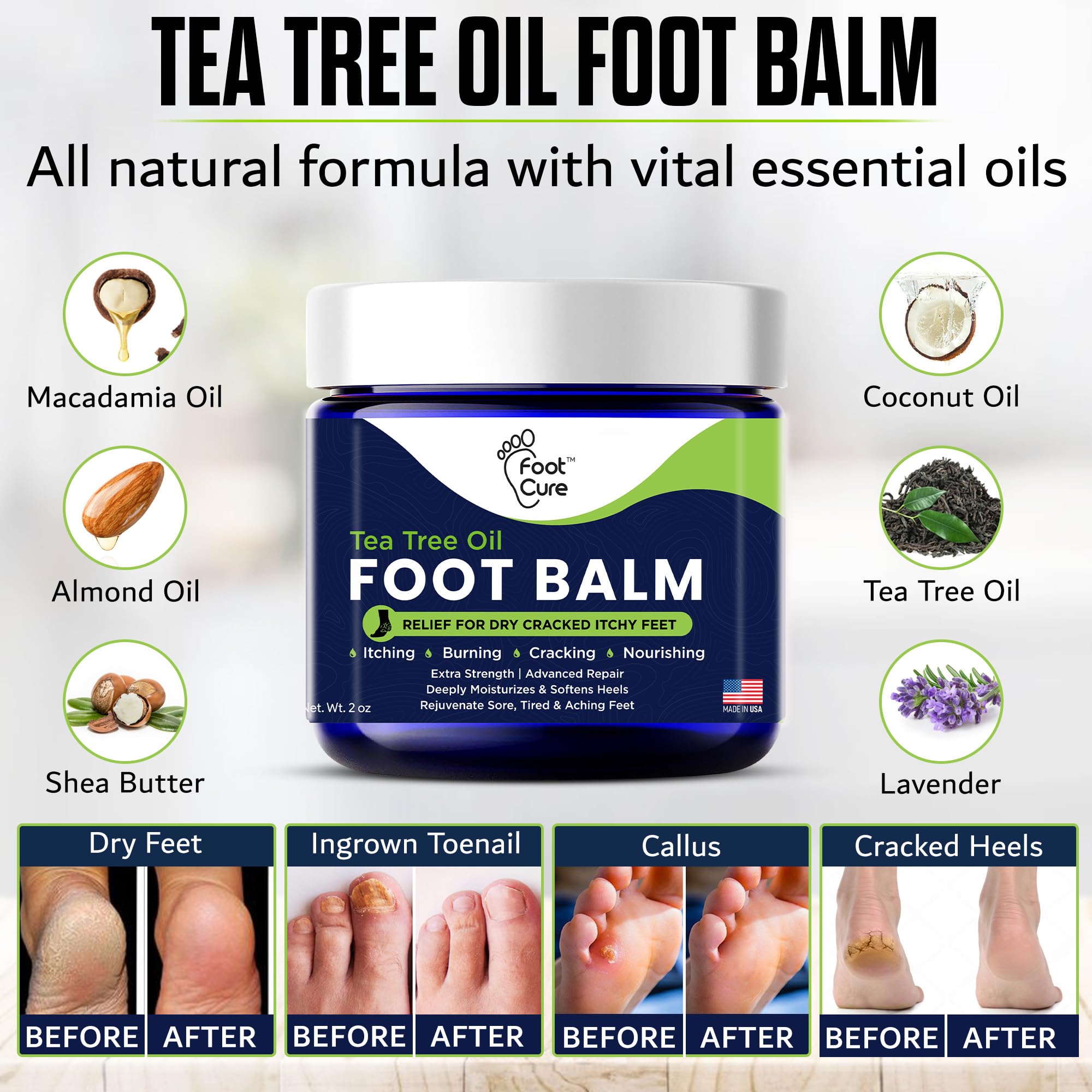 FOOT CURE Tea Tree Oil Balm softening rough heel skin close-up.