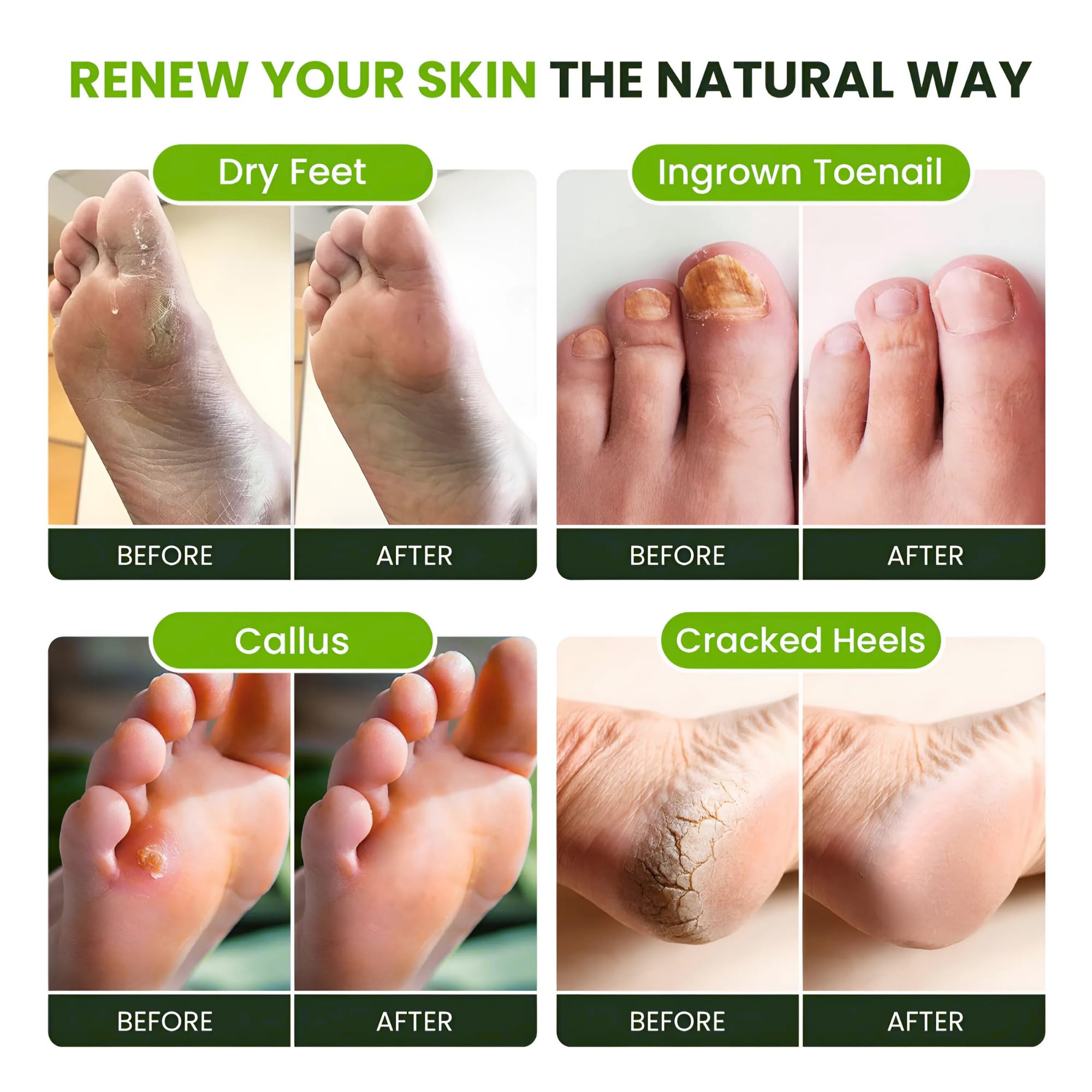 FOOT CURE Tea Tree Oil Foot Soak ingredients closeup emphasizes natural oils.