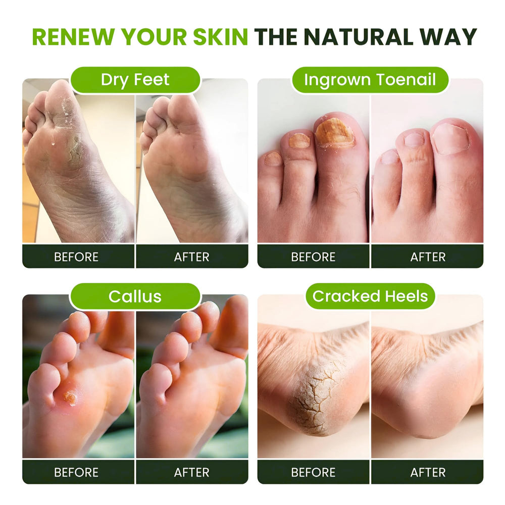 FOOT CURE Tea Tree Oil Foot Soak ingredients closeup emphasizes natural oils.