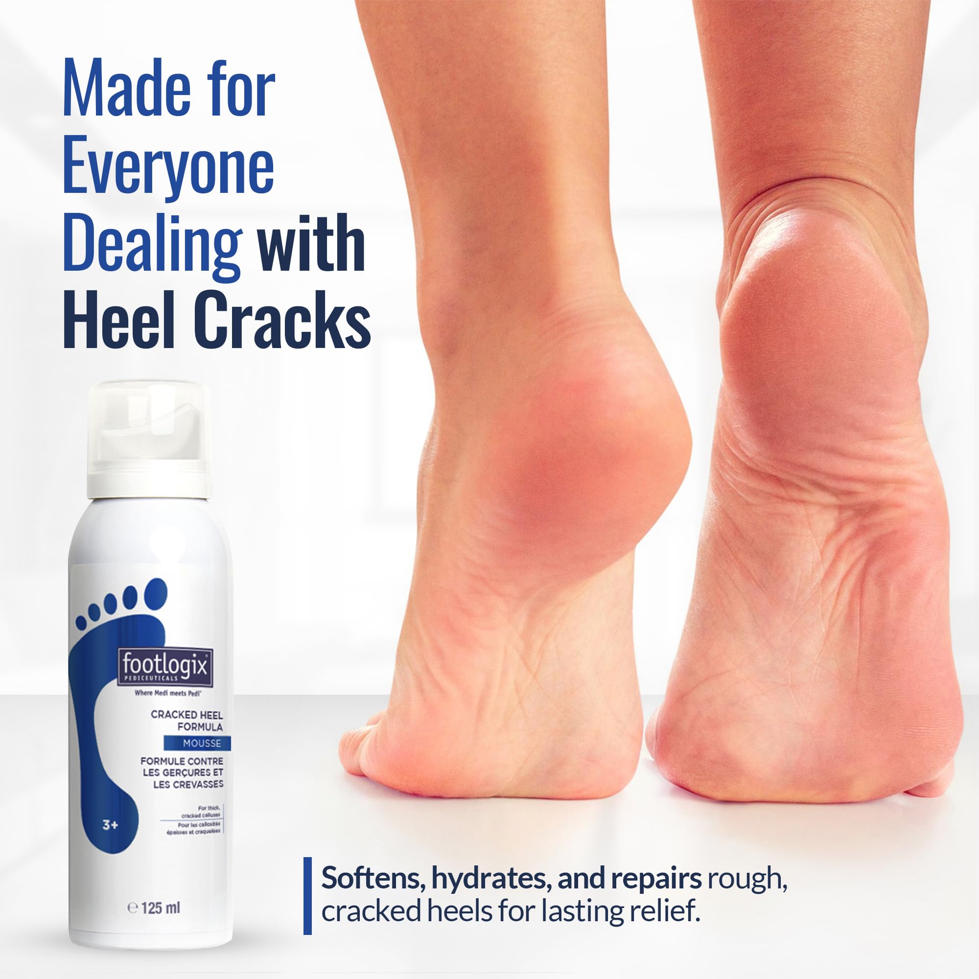 Footlogix Cracked Heel Formula ultra-dry heel relief preview
