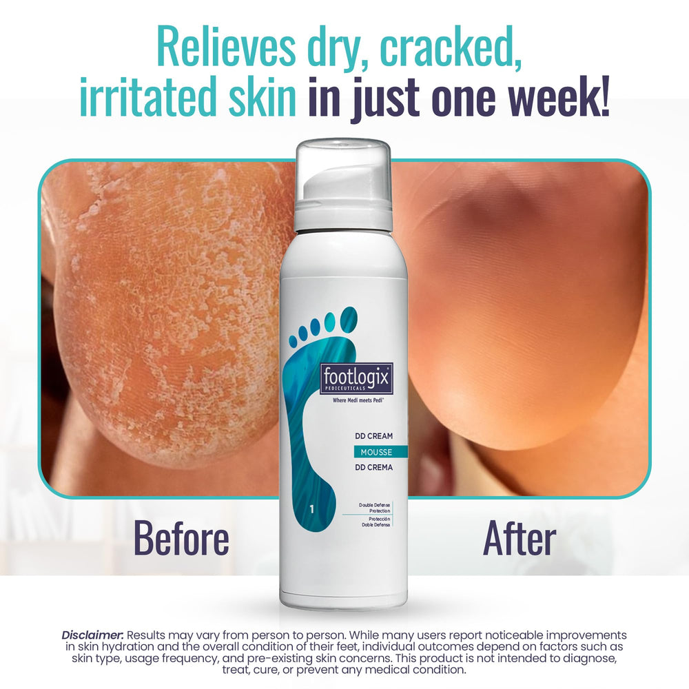 DD Cream Mousse ingredients with urea and Spiraleen nourish dry skin.