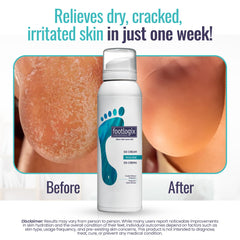 DD Cream Mousse ingredients with urea and Spiraleen nourish dry skin.