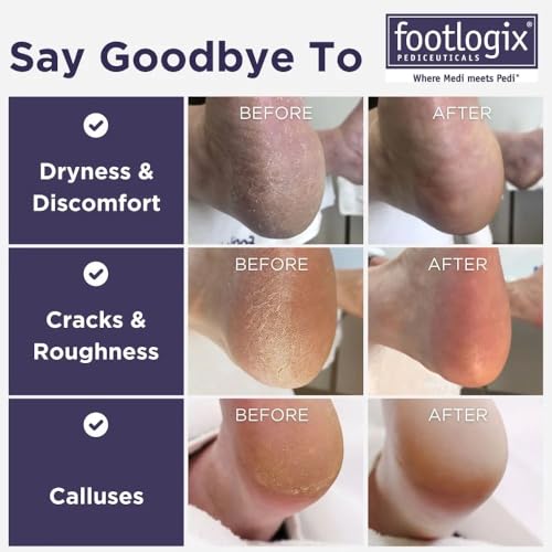 Footlogix double-sided foot file with coarse and fine grit for exfoliation
