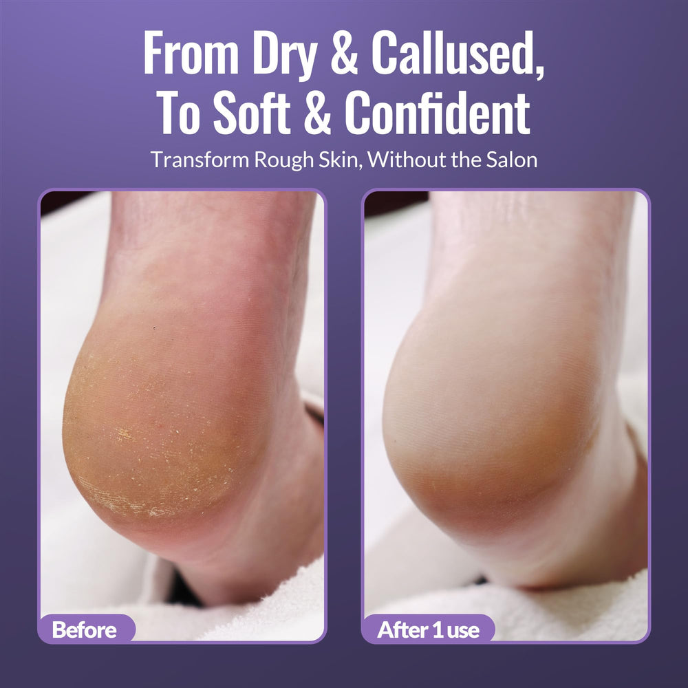 Footlogix Dry heel care steps illustration for at-home maintenance
