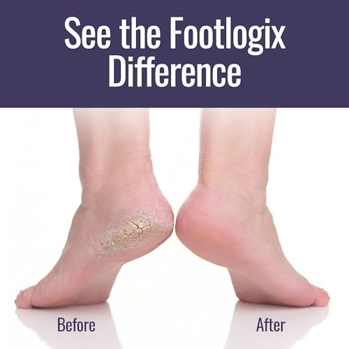 Footlogix Foot Care Kit packshot with tools for home pedicure