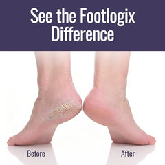 Footlogix Foot Care Kit packshot with tools for home pedicure