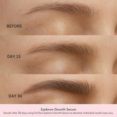 Forchics Eyebrow Growth Serum applicator demonstrates precise daily swipe