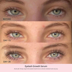 ForChics applicator applying serum along lash line for precise nightly use.